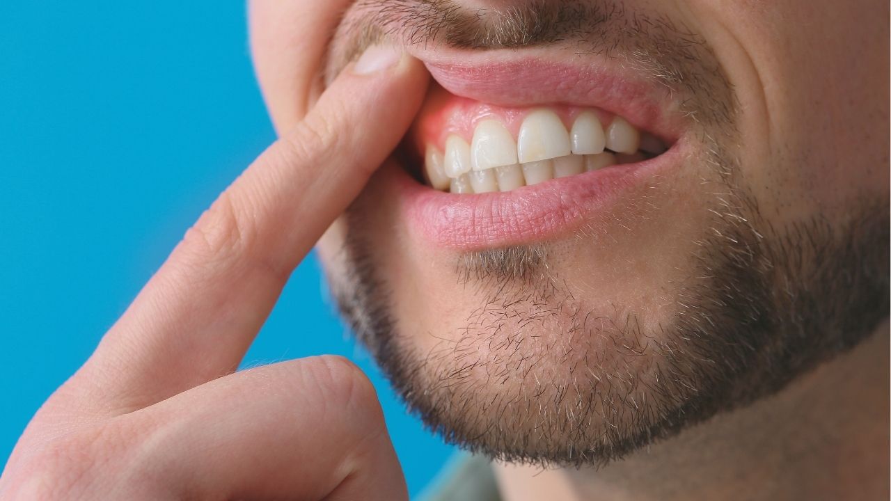 do-zyns-cause-gum-cancer